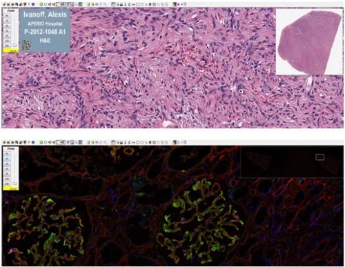 Software de análisis de imágenes - Aperio ImageScope - Leica Biosystems - médico / de laboratorio de histopatología