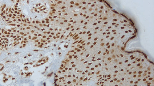 Medio reactivo - akt-phosphorylated - Leica Biosystems - para inmunohistoquímica / líquido / para antígenos