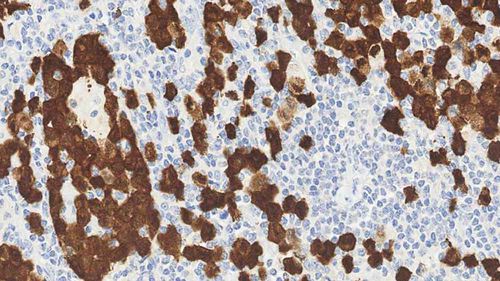 Reactivo anticuerpos - ALK-L-CE-H - Leica Biosystems - anticuerpo monoclonal / para inmunohistoquímica / para histopatología