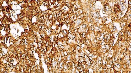 Reactivo anticuerpo monoclonal - PA0963-U - Leica Biosystems - anticuerpos / para oncología / para histopatología