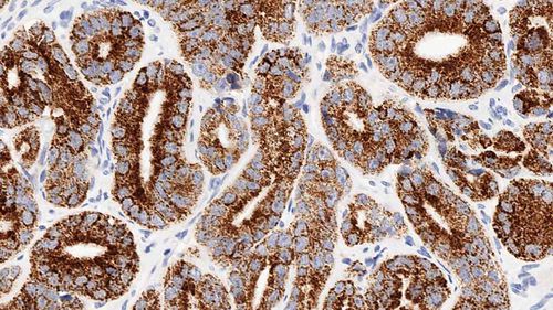 Reactivo anticuerpo monoclonal - AMACR-L-CE - Leica Biosystems - anticuerpos / para inmunohistoquímica / líquido