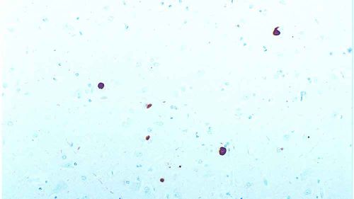 Reactivo anticuerpo monoclonal - ASYN-L - Leica Biosystems - anticuerpos / para inmunohistoquímica / para western blot