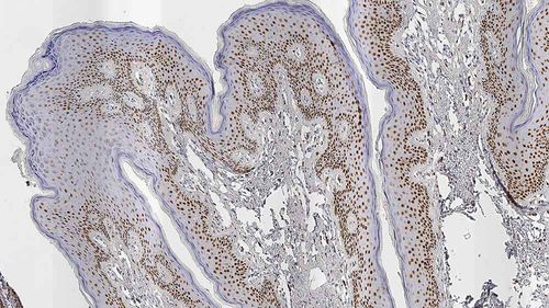 Reactivo anticuerpo monoclonal - AR27 - Leica Biosystems - anticuerpos / para histopatología / para inmunohistoquímica
