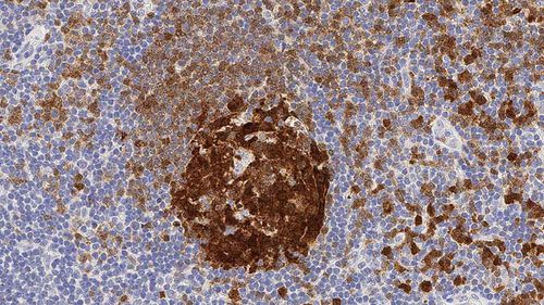 Reactivo anticuerpos - BOB-1 - Leica Biosystems - anticuerpo monoclonal / para histopatología / de diagnóstico