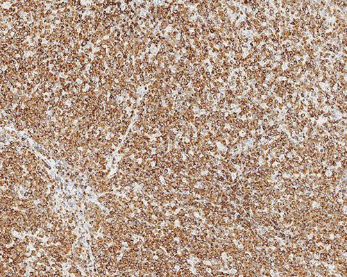 Reactivo anticuerpos - Bcl-2  - Leica Biosystems - anticuerpo monoclonal / de tejidos / para inmunohistoquímica