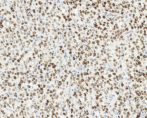 Reactivo anticuerpos - Bcl-6  - Leica Biosystems - anticuerpo monoclonal / para la investigación / de diagnóstico