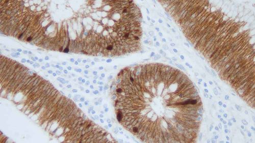 Reactivo anticuerpo monoclonal - B-CAT-L-CE - Leica Biosystems - anticuerpos / de tejidos / para inmunohistoquímica
