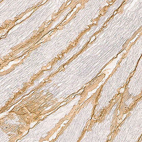 Reactivo anticuerpo monoclonal - B-DG-CE - Leica Biosystems - de diagnóstico / para inmunohistoquímica / para inmunodetección