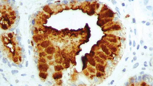 Reactivo anticuerpo monoclonal - PA0424-U - Leica Biosystems - para histopatología / de diagnóstico / de tejidos