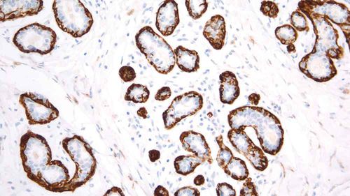 Reactivo anticuerpos - PA0416-U - Leica Biosystems - anticuerpo monoclonal / para histopatología / para inmunohistoquímica