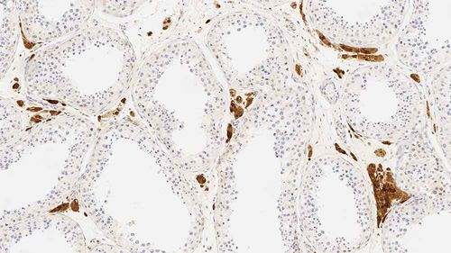 Reactivo anticuerpos - CALRET566-L-CE - Leica Biosystems - anticuerpo monoclonal / de diagnóstico / para inmunohistoquímica