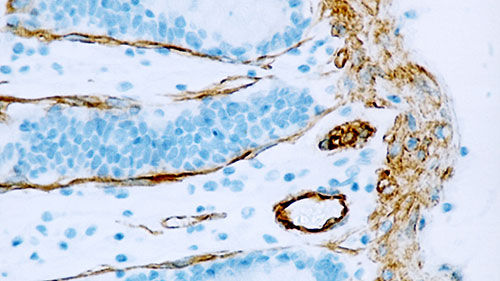 Reactivo anticuerpo monoclonal - CAVEOLIN-1-L - Leica Biosystems - anticuerpos / para inmunohistoquímica / para la investigación