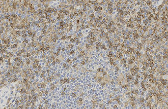 Reactivo anticuerpo monoclonal - CD4 - Leica Biosystems - anticuerpos / para histopatología / para inmunohistoquímica