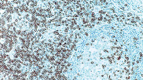 Reactivo anticuerpos - CD5 - Leica Biosystems - anticuerpo monoclonal / para inmunohistoquímica / para histopatología