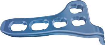 Placa de compresión para clavícula - ORTHO CARE - lateral / bloqueada / metálica