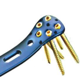 Placa de compresión para fémur - ORTHO CARE - porción proximal / metálica