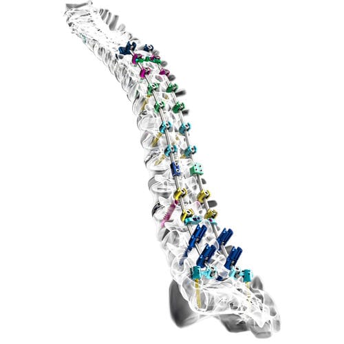 Sistema de osteosíntesis toracolumbar - INERTIA® - Nexxt Spine - vía posterior / para adulto