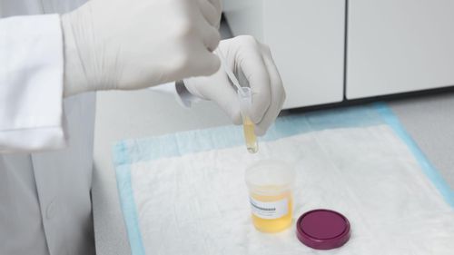 Kit de prueba de fentanilo - ARK™  - Siemens Healthineers - Laboratory Diagnostics - de estupefacientes / de orina