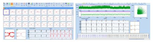 Software de análisis - CardioTrak  - Beneware Medical Equipment - para Holter cardíaco / médico