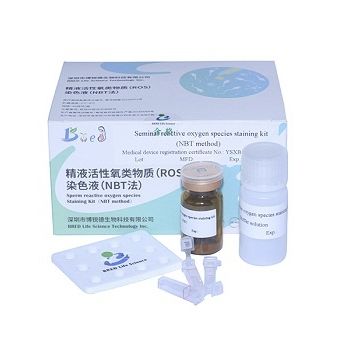 Kit de reactivos solución de coloración - NBT  - Bred Life Science Technology Inc . - para análisis de semen