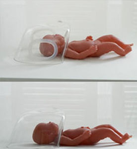 Campana de oxígeno neonatal - Farstar (Wuxi) Medical Equipment - para ventilación artificial