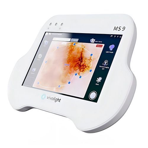 Dermatoscopio de vídeo - LumeaVision MS9 - Shenzhen Vivolight Medical Device & Technology - LED UV / para cámara de fotos