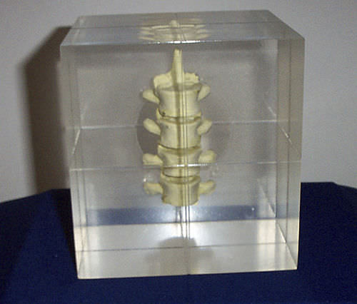 Fantoma de prueba para radiología - RS-1400 - Radiology Support Devices - de columna vertebral