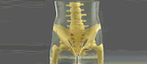 Fantoma de prueba para radiología - RS-113T - Radiology Support Devices - de pelvis