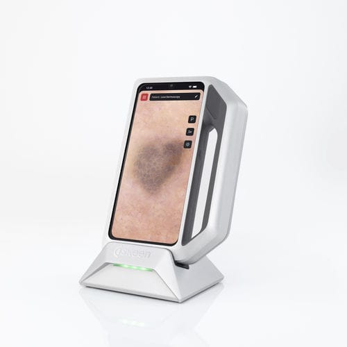 Dermatoscopio de vídeo - FotoFinder Systems - LED blanca