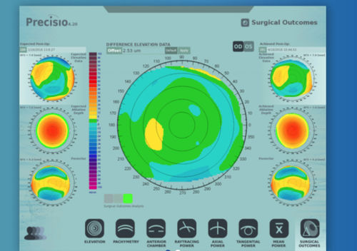 Software de análisis - iVerify® - iVis Technologies - de verificación / médico / para cirugía oftalmológica