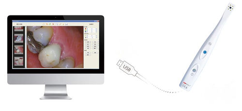 Cámara intraoral - SuperVista-----HDI-210 - Handy Technologies - digital / CMOS / USB