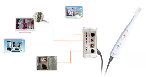 Cámara intraoral - CamAssist-----HDI-300/400A - Handy Technologies - digital / CCD