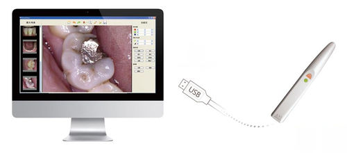 Cámara intraoral - EzCam - Handy Technologies - digital / CMOS