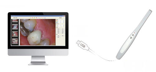 Cámara intraoral - SuperCam - Handy Technologies - digital / CMOS / USB