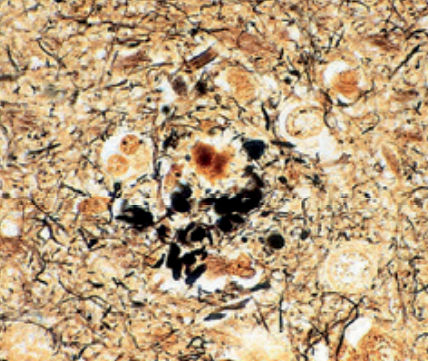 Reactivo solución de coloración - Bielschowsky   - BIO-OPTICA Milano - para citología / para histologia