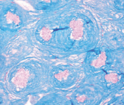 Reactivo solución de coloración - Enzymatic digestion hyaluronidase   - BIO-OPTICA Milano - para histologia / para citología