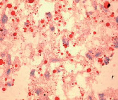 Reactivo solución de coloración - Oil red 0 - BIO-OPTICA Milano - para citología / para histologia