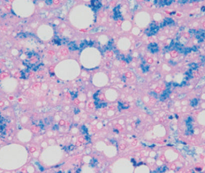 Reactivo solución de coloración - Perls - BIO-OPTICA Milano - para histologia / para citología