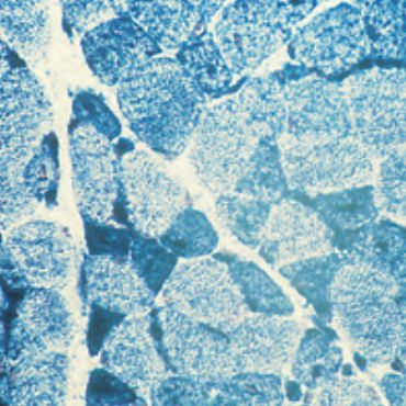 Reactivo solución de coloración - 30-30117LY  - BIO-OPTICA Milano - para histologia