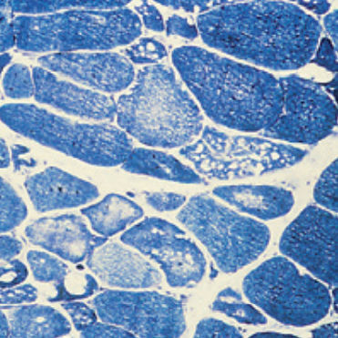 Reactivo solución de coloración - 30-30116LY  - BIO-OPTICA Milano - para histologia
