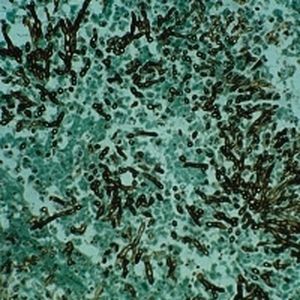 Reactivo solución de coloración - Grocott MW   - BIO-OPTICA Milano - para citología / para histologia