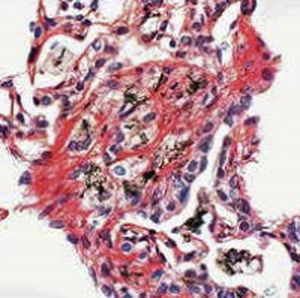 Reactivo solución de coloración - Sirius Red - BIO-OPTICA Milano - para citología / para histologia