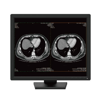 Monitor médico - R191 - Nanjing Jusha Display Technology - de diagnóstico / 1280 x 1024 / 19"
