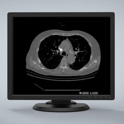 Monitor médico - R193G - Nanjing Jusha Display Technology - 1280 x 1024 / LCD / LED