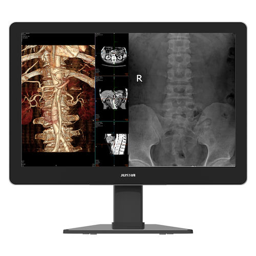 Monitor médico - C630G - Nanjing Jusha Display Technology - de diagnóstico / mamográfico / de alta definición