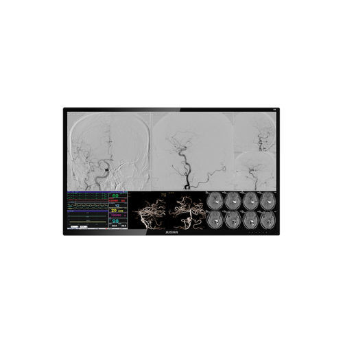 Monitor médico - E550EG - Nanjing Jusha Display Technology - para sala de operaciones / para endoscopia / 3.840x 2.160