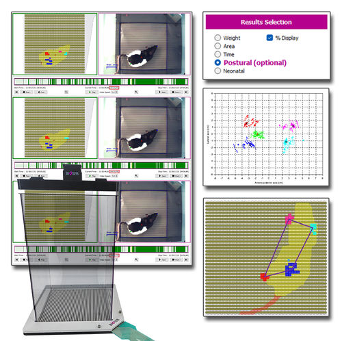 Software médico - BIO-DWB2-POSTUR - Bioseb - de laboratorio / de análisis / de oído interno