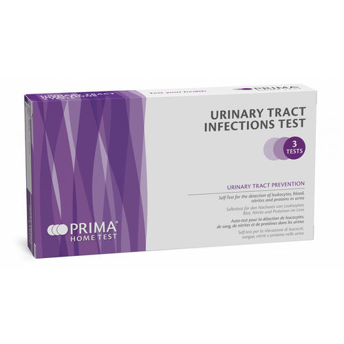 Prueba rápida de gripe - 100058-3 - PRIMA Lab - de infección de las vías urinarias / de uso doméstico / para antígenos