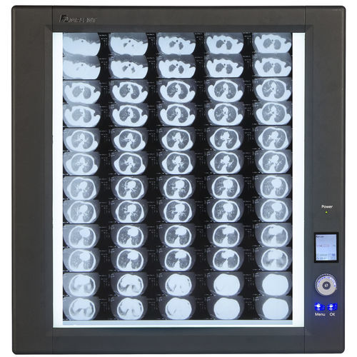Negatoscopio digital - Trimline - Wolf X-Ray Corporation - 1 pantalla / 2 pantallas / 4 pantallas