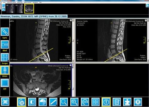 Software de radiología - iQ-VIEW/PRO - IMAGE Information Systems - para medicina nuclear / para informes / de visualización